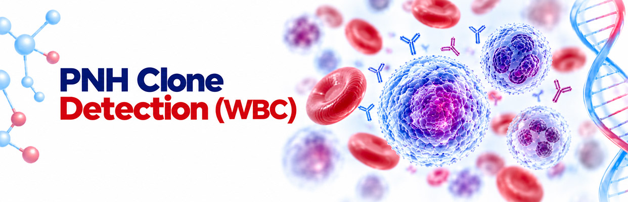 PNH Clone Detection (WBC)