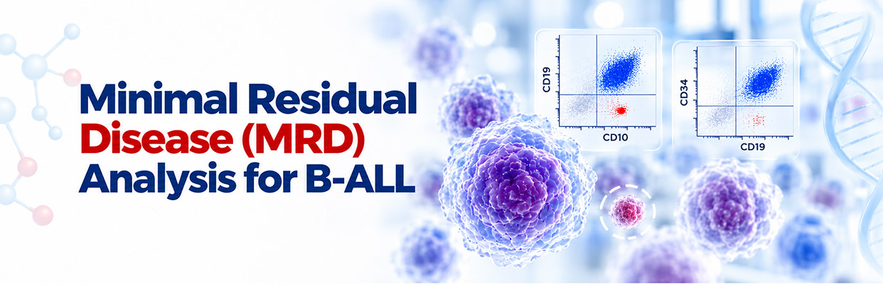 Minimal Residual Disease (MRD) Analysis for  B-ALL