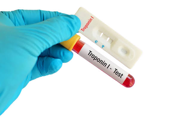 Troponin-I (cTnI)