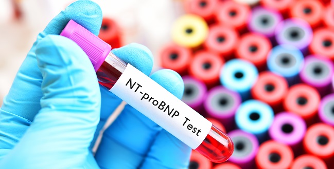 NT - proBNP / proBNP