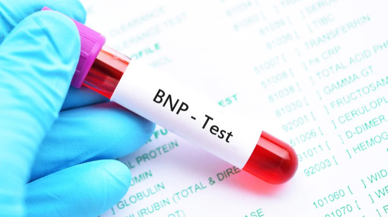 B N P