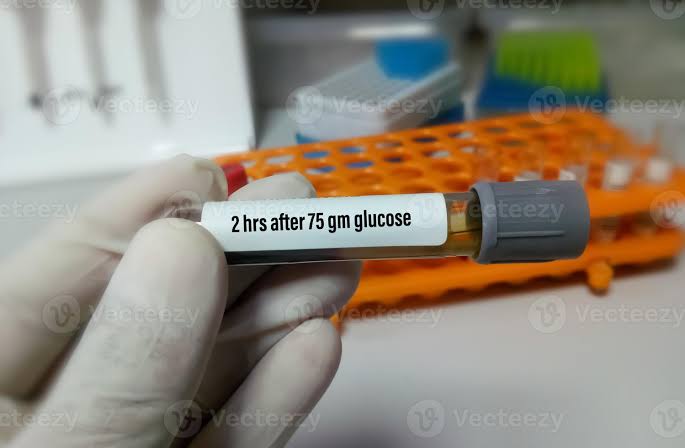 2 Hour ABF/After Lunch/After75gm Glucose