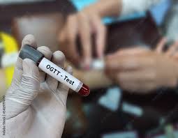 OGTT - Oral Gucose Tolerance Test