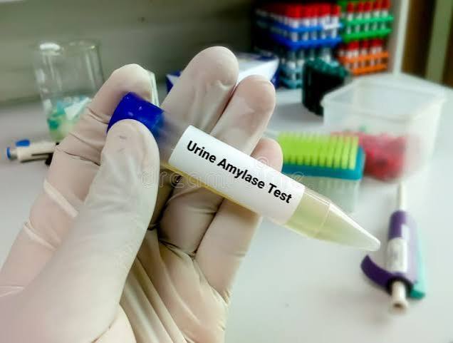 Urine Amylase