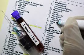 Lipase
