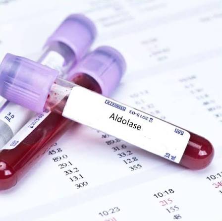 Aldolase