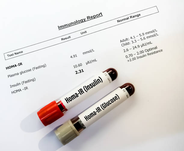 Homa IR/ Insulin resistance