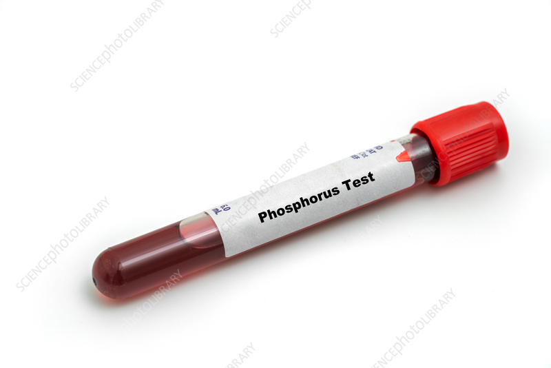 Phophate/Phosphorus (PO4)/Inorganic Phosphatase