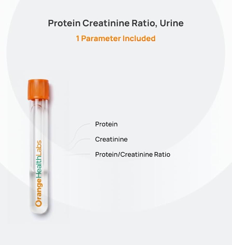 Urine PCR (Urine Protein - to - Creatinine Ratio)