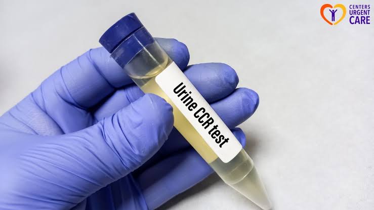 CCR (Creatinine clearance rate)