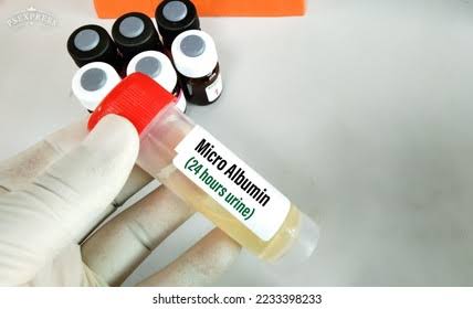 Urine Microalbumin 9=(mALB) / 24 - Hour Urinary Microalbumin