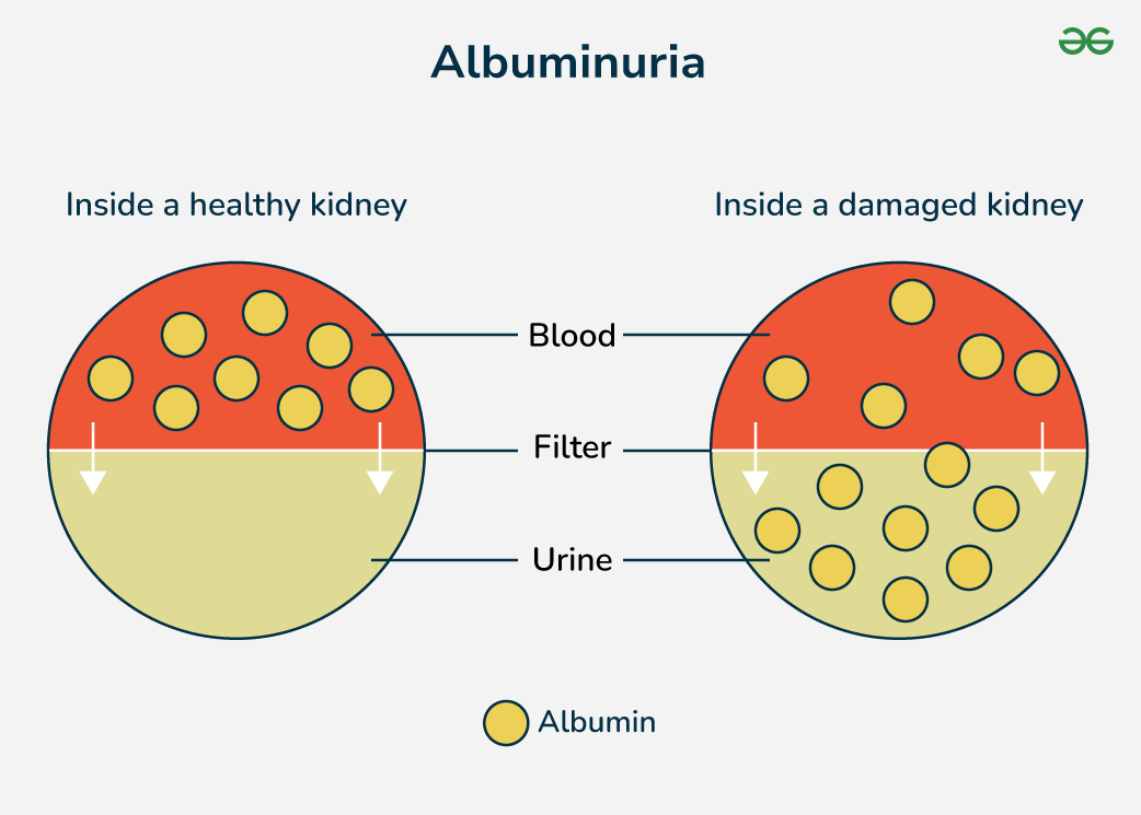 Urine albumin