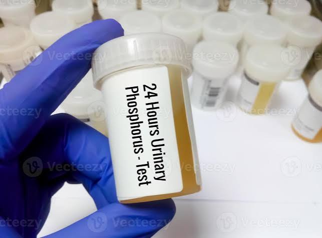24 - Hour Urine Phosphate