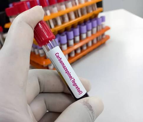 Serum Carbamazepine
