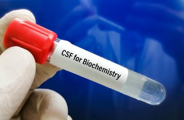 Fluid for Biochemical test (Sugar + Protein)