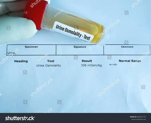 Urinary osmolaity