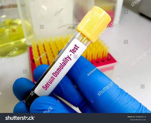 Serum osmolality