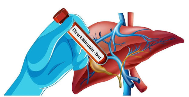 Bilirubin Direct (Bili - I)