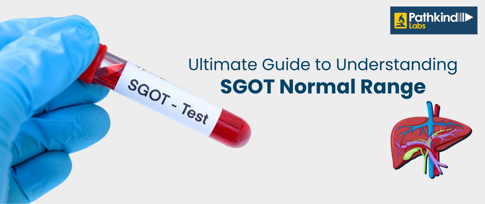 SGOT (AST)