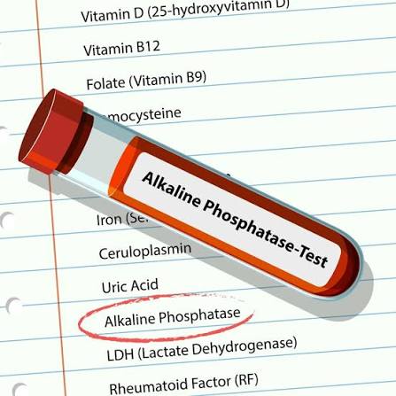 Alkaline phosphatase (ALP)