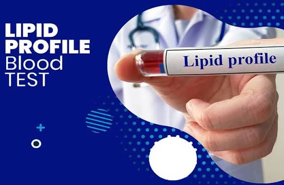 Fasting Lipid Profile