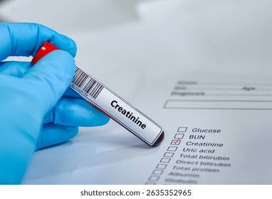Creatinine