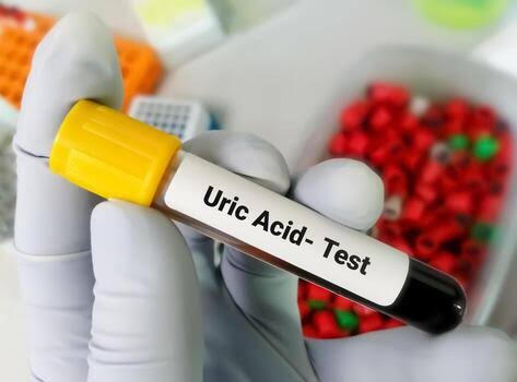 Uric Acid