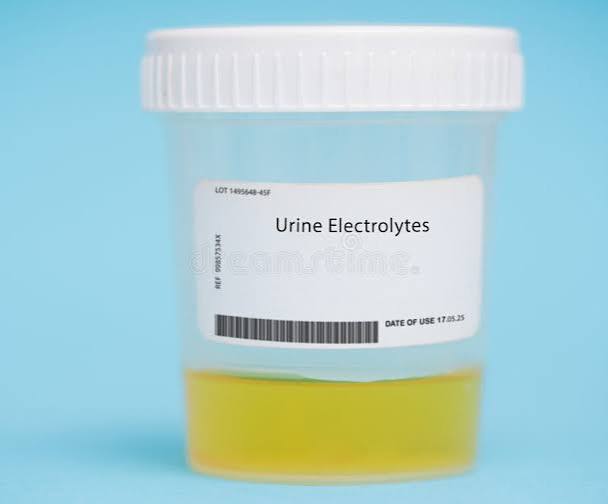 Urine Electrolytes