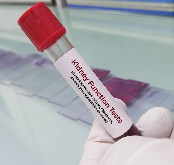 Kidney Function Test ( KFT/RFT) - CREA , BUN , UA , eGFR