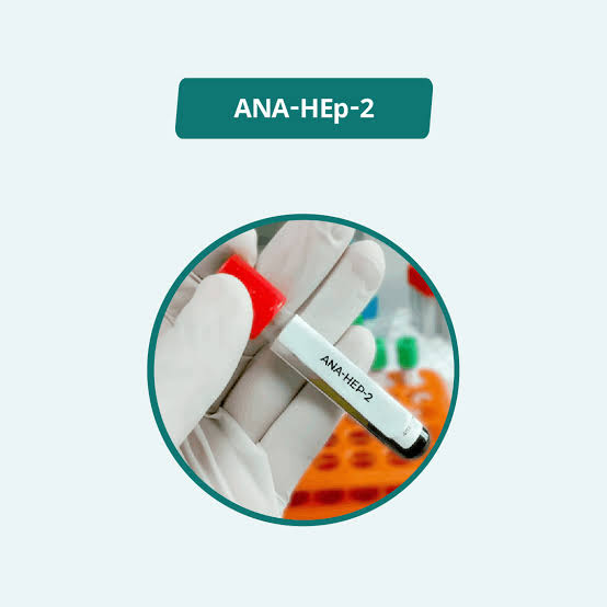 ANA - HEp2 ( IFA )