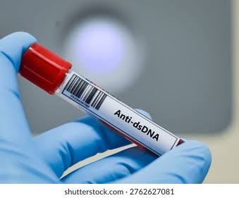Anti - DS - DNA
