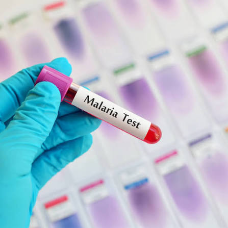 ICT for Malaria / Malaria parasite ( MP )