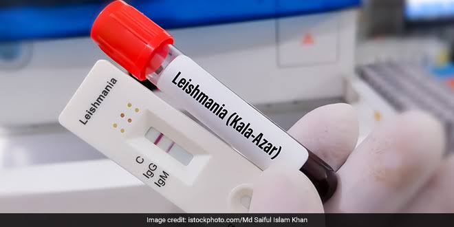 ICT for Kala Azar lgG / Leishmaniasis