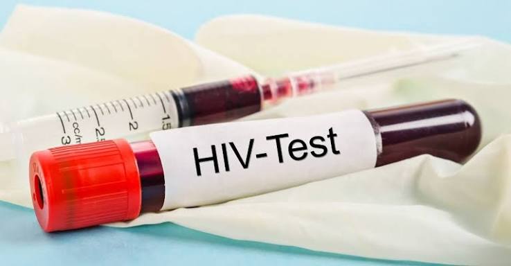 Anti - HIV (1 & 2) / Anti - HIV