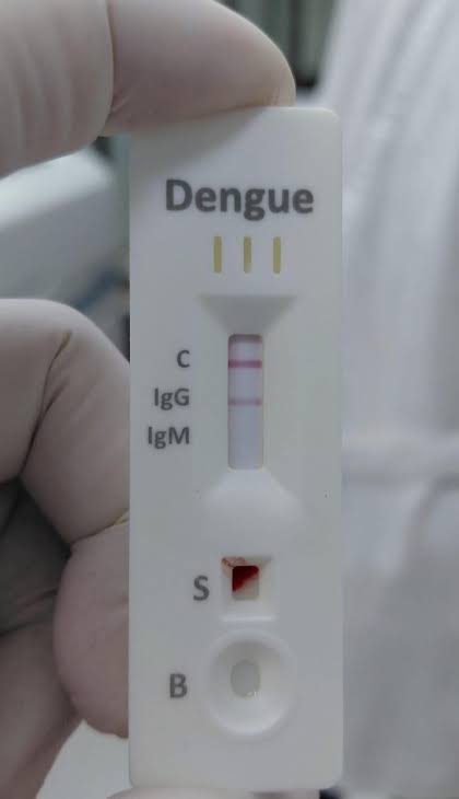 Anti - Dengue lgG (Quantity)