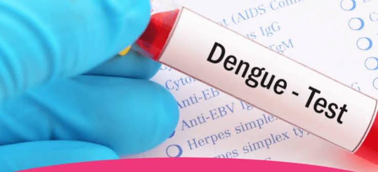 Anti - Dengue lgM (Quantity)