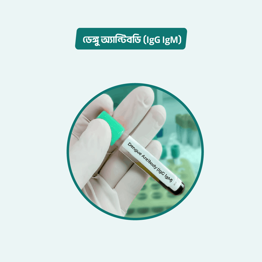 Anti Dengue lgG & lgG (ICT)