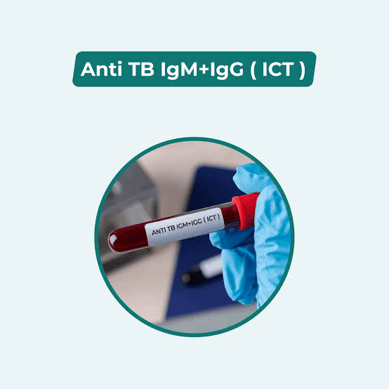 Anti TB igG & lgM (ICT)