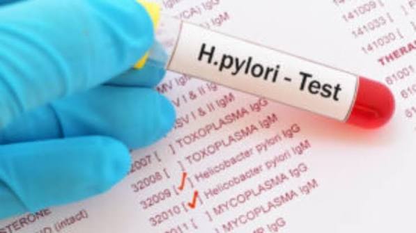 Anti H. Pylori lgG (Helicobacter pylori lgG)