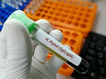 Anti H. Pylori lgM (Helicobacter pylori lgM)