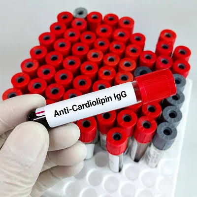 Anti - Cardiolipin lgG