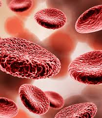 Anti - Phospholipid  Ab (APA)