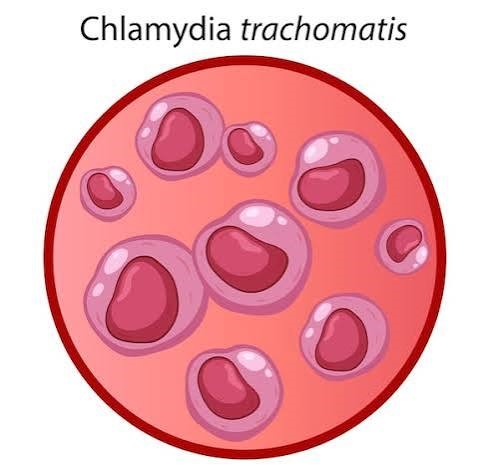 Anti- Chlamydia trachomatis lgM