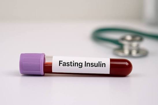 Fasting Insulin/Insulin