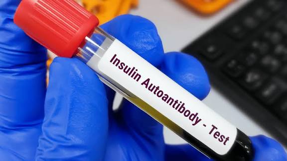Insulin Antibodies