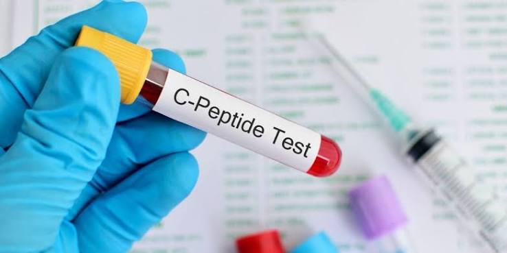 Fasting C- Peptide / C-Peptide