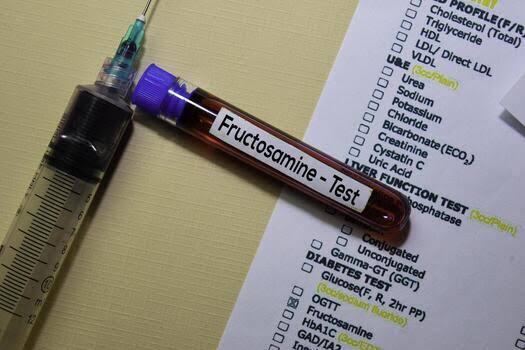 Fructosamine