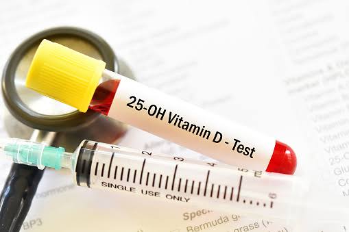 Vitamin D/ 25 - OH vitamin D