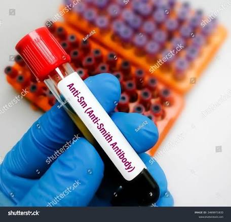 Anti- Sm/ Anti- Smith Antibody