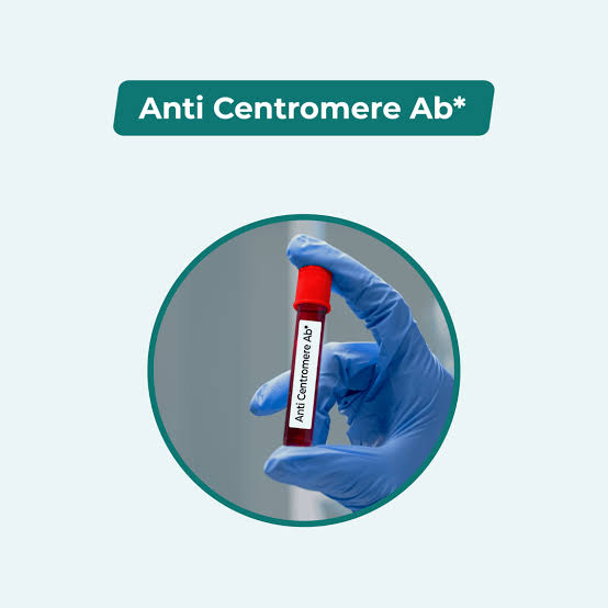 Anti- Centromere Antibody